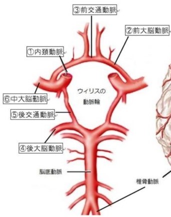 脳血管