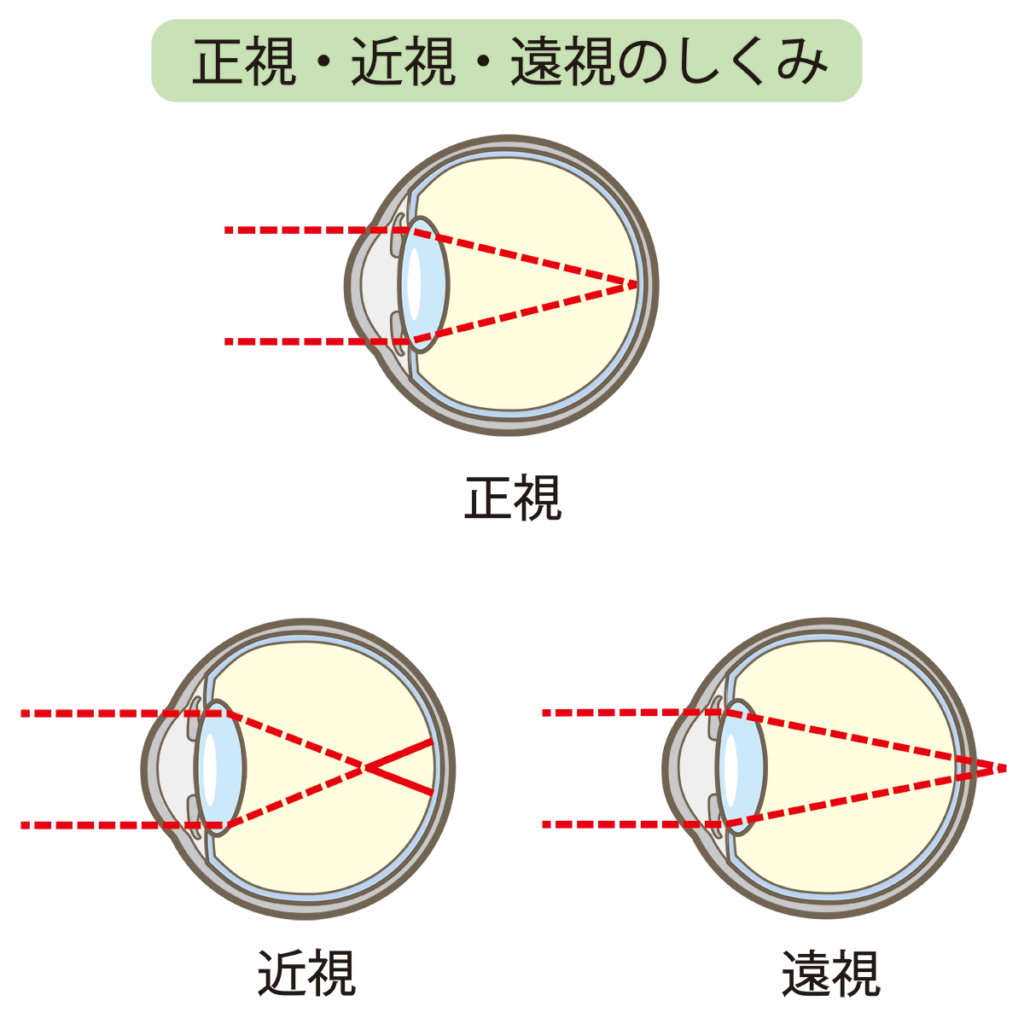 近視の仕組み